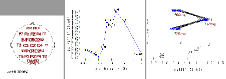 \scalebox{0.7}[0.7]{\includegraphics[width=4cm]{covs1y.ps}
\includegraphics[width=5cm]{covs1z.ps}
\includegraphics[width=5cm]{covs1xt.ps}}