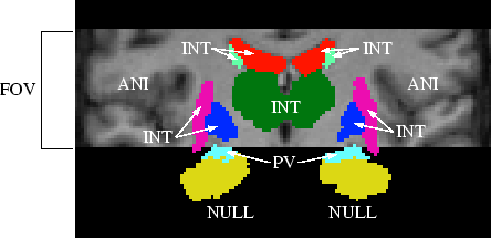 \includegraphics[width=0.8\textwidth]{egshapes2.eps}